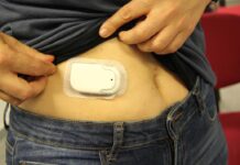 El Hospital Universitario del Sureste añade a su cartera de servicios la implantación de bombas de insulina en adultos